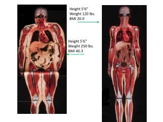 Height 5’6” Weight 250 lbs. BMI 40.3