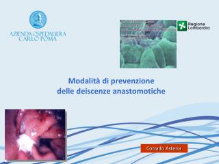 Modalità di prevenzione delle deiscenze anastomotiche