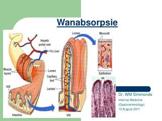 Wanabsorpsie