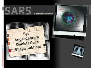 SARS &amp; bacteria and viruses