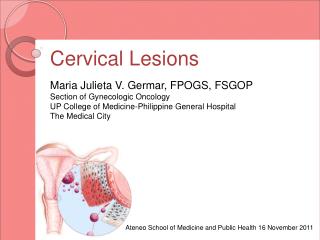 Cervical Lesions