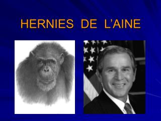 HERNIES DE L’AINE