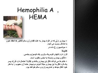 Hemophilia A , H EMA