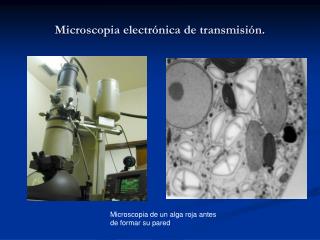 Microscopia electrónica de transmisión.