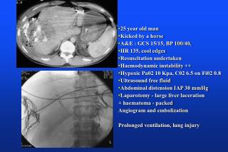 25 year old man Kicked by a horse A&amp;E : GCS 15/15, BP 100/40, HR 135, cool edges