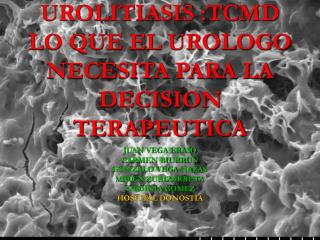 UROLITIASIS :TCMD LO QUE EL UROLOGO NECESITA PARA LA DECISION TERAPEUTICA