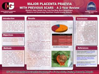 Table: Comparison of Doppler findings of major praevia with previous scars and final diagnosis.