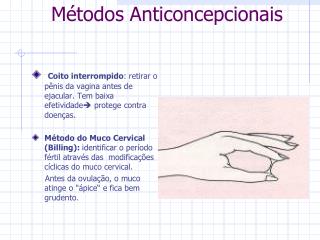 Métodos Anticoncepcionais