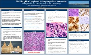Non Hodgkins Lymphoma in the puerperium, a rare case.