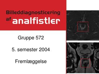 Gruppe 572 5. semester 2004 Fremlæggelse