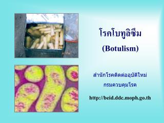 โรคโบทูลิซึม (Botulism)