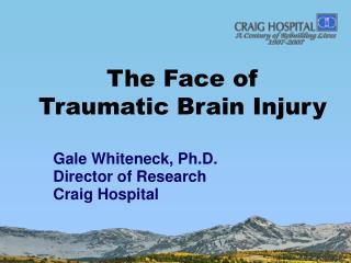 The Face of Traumatic Brain Injury