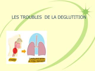 LES TROUBLES DE LA DEGLUTITION