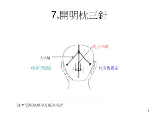7, 開明枕三針
