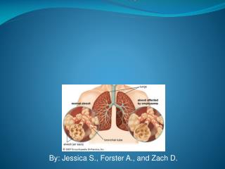 EMPHYSEMA