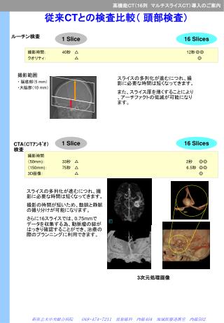 従来 CT との検査比較（ 頭部検査）