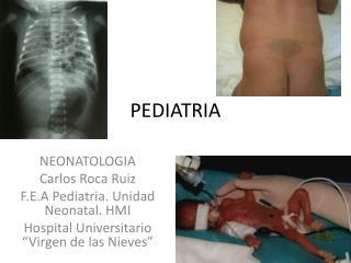 PEDIATRIA