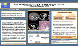 TUMOR THROMBOEMBOLISM ASSOCIATED WITH HEPATOCELLULAR CARCINOMA