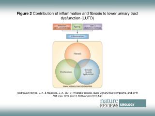 Figure 2 Contribution of inflammation and fibrosis to lower urinary tract dysfunction (LUTD)