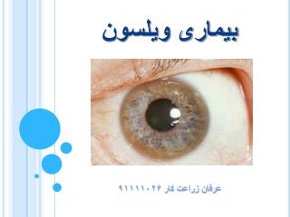 بیماری ویلسون