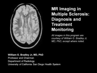 MR Imaging in Multiple Sclerosis: Diagnosis and Treatment Monitoring