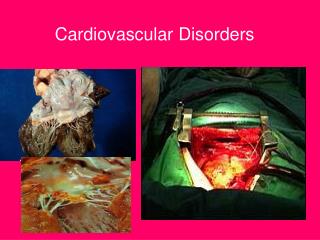 Cardiovascular Disorders