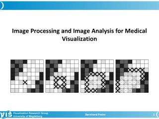 Image Processing and Image Analysis f o r Medical Visualization