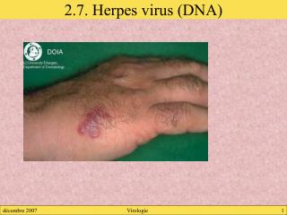 2.7. Herpes virus (DNA)