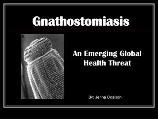 Gnathostomiasis