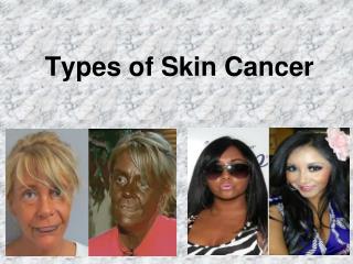 Types of Skin Cancer