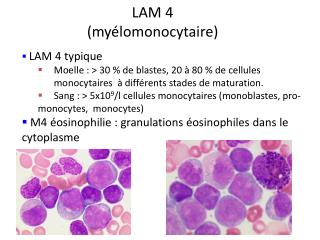 LAM 4 (myélomonocytaire)