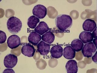 Hematologic Malignancies