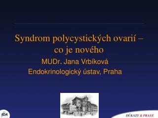 Syndrom polycystických ovarií –co je nového