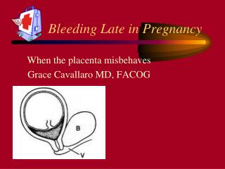 Bleeding Late in Pregnancy