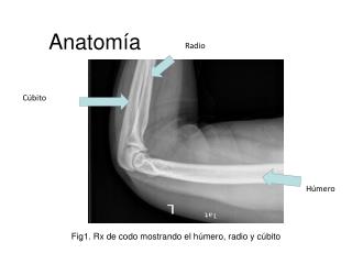 Anatomía