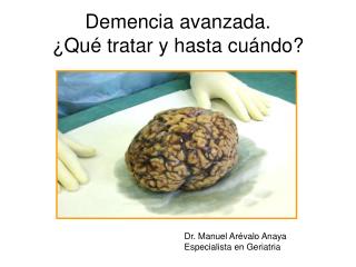 Demencia avanzada. ¿Qué tratar y hasta cuándo?