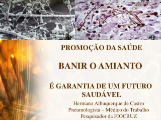 PROMOÇÃO DA SAÚDE BANIR O AMIANTO É GARANTIA DE UM FUTURO SAUDÁVEL