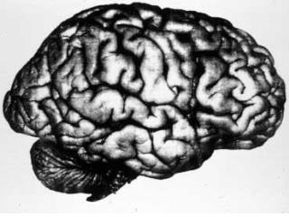 Side view of human brain