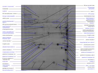 glutathione S transferase Yfyf