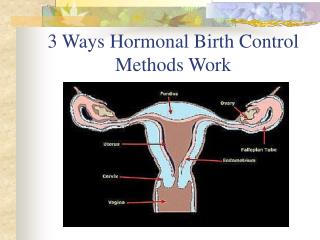 3 Ways Hormonal Birth Control Methods Work