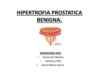 HIPERTROFIA PROSTATICA BENIGNA.