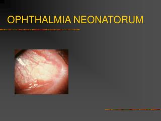 OPHTHALMIA NEONATORUM