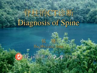 脊柱的 CT 诊断 Diagnosis of Spine