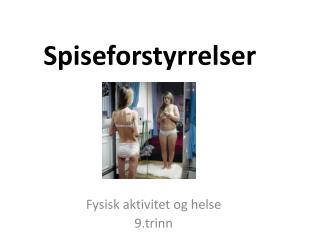 Spiseforstyrrelser