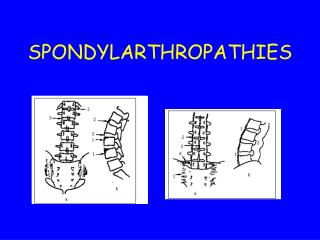SPONDYLARTHROPATHIES