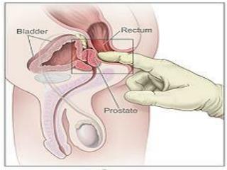 Procedure