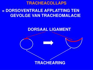 TRACHEACOLLAPS = DORSOVENTRALE AFPLATTING TEN 		GEVOLGE VAN TRACHEOMALACIE