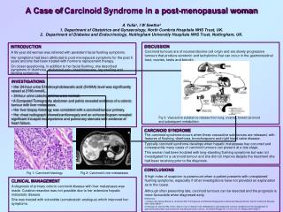 INTRODUCTION A 56 year old woman was referred with persistent facial flushing symptoms.