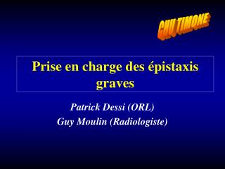 Prise en charge des épistaxis graves