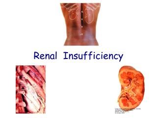 Renal Insufficiency